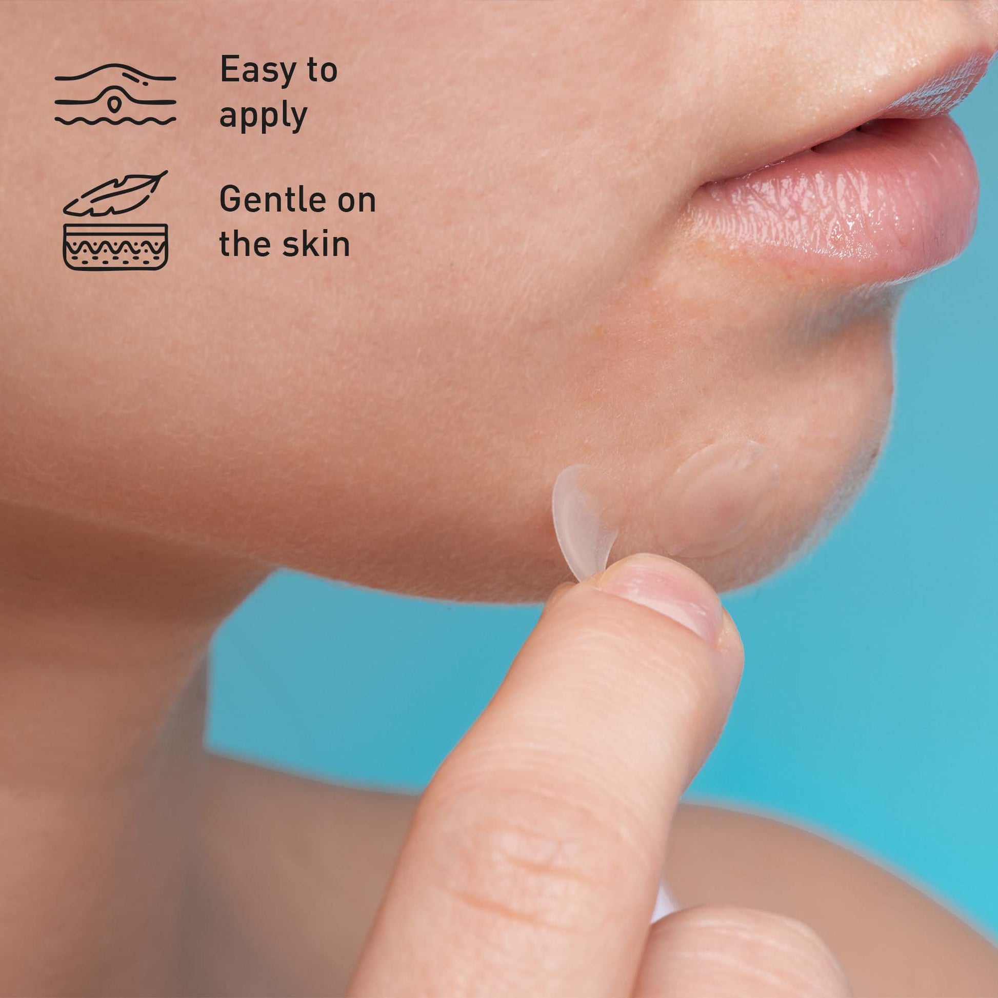 Pimple Emergency Kit-4